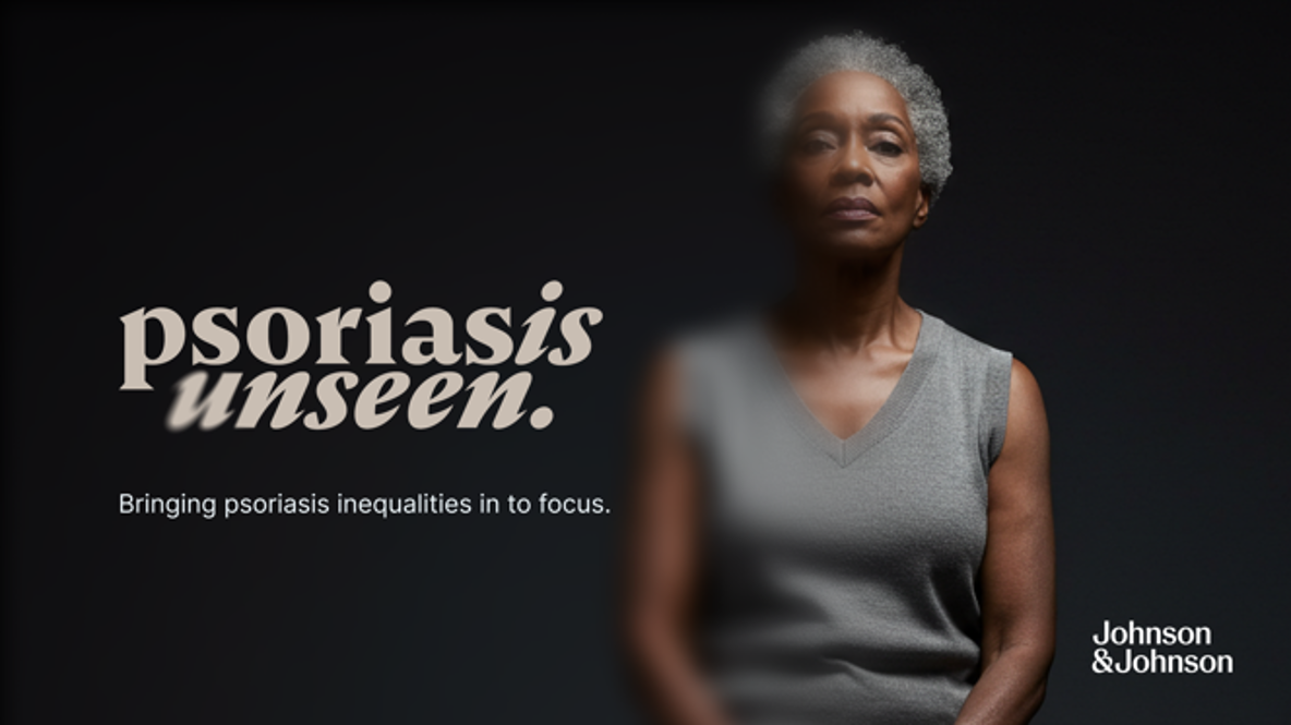 Psoriasis Unseen. Bringing psoriasis inequalities into focus. A portrait of a woman with part of the image blurred, with the Johnson & Johnson logo.